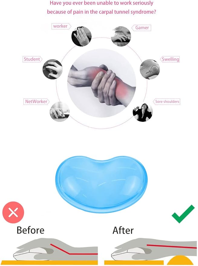 Gel Keyboard & Mouse Wrist Rest Set - Keyboard Wrist Rest Pad & Mouse Support for Office Gaming Pad Computer Laptop Ergonomic Comfortable Pain Relief- Pad Set (Mouse Support Only)