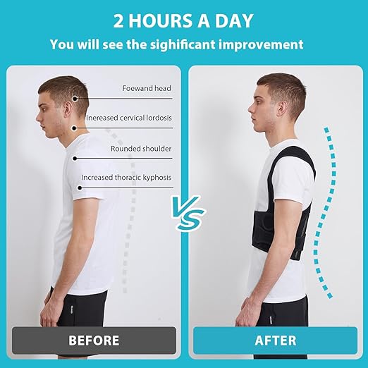 KD Back Brace Posture Corrector for Women and Men - Back Straightener Ideal for Scoliosis, Hunchback, Spine Corrector, Adjustable Support Upper and Lower Back Pain Relief